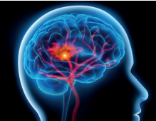 système nerveux dans une tête : psychotraumatisme - définition megadico